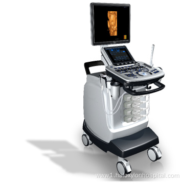 hospital mobile color ultrasound machine laptop cardiac